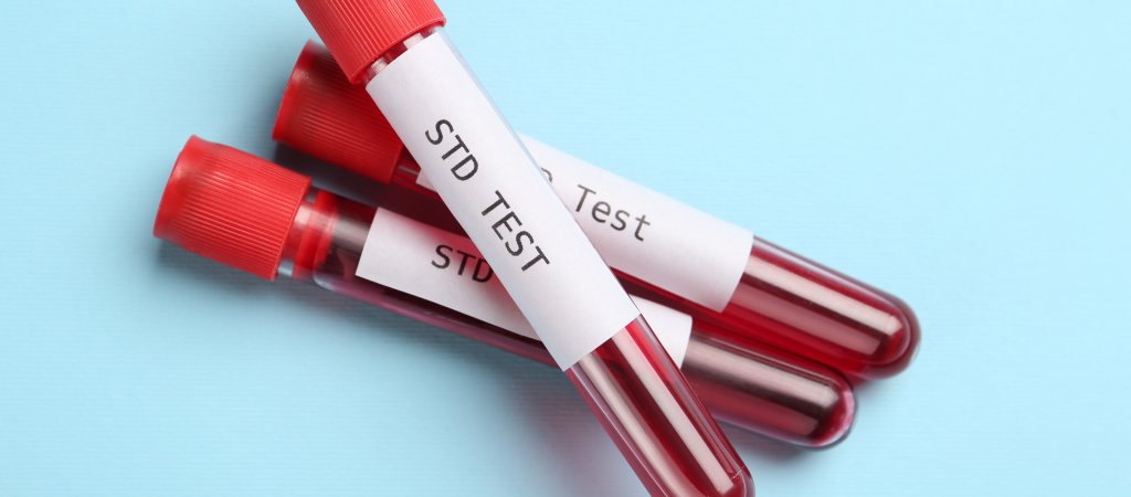 HIV- UND STI-TESTS UND BERATUNG