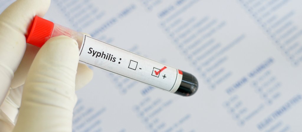 Neuer Anstieg der Syphilis-Fälle