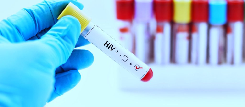 HIV-Infektionen steigen an