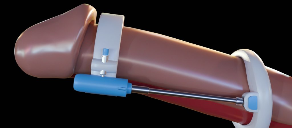 Ist Penisvergrößerung ein Tabu-Thema? // © Love Employee