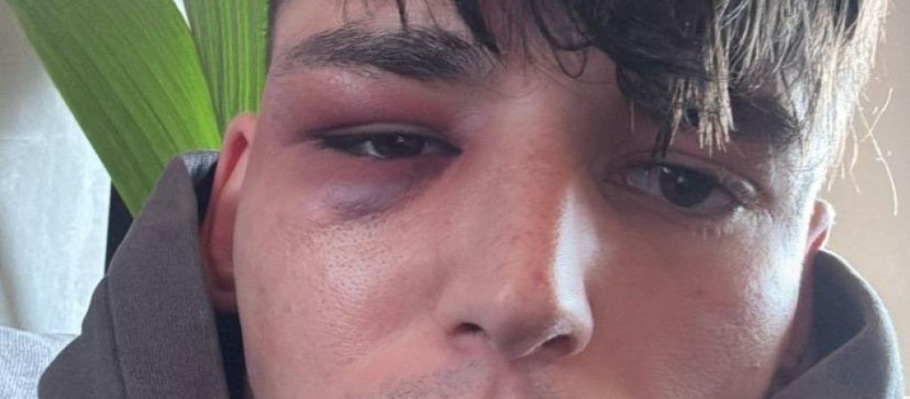 Anschlag auf Pascal Kaiser 