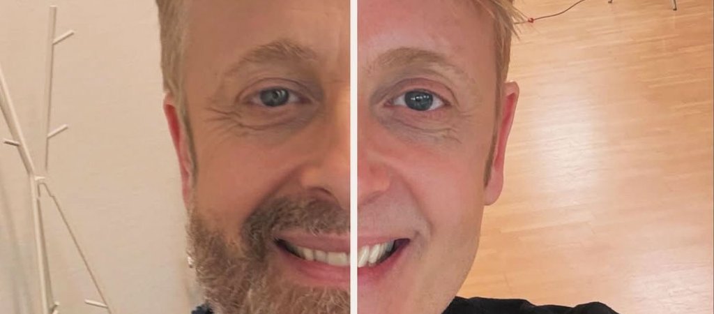 Ross Antonys Typveränderung sorgt für Wirbel