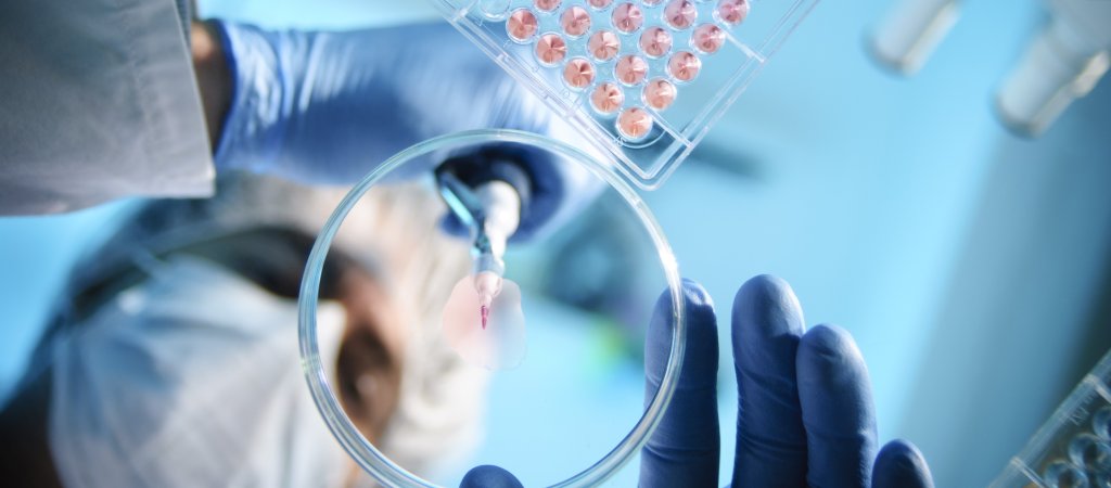 Fortschritte im Bereich HIV