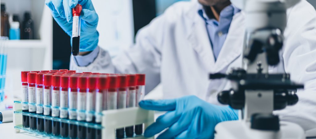 UNAIDS warnt vor Rückschritten 