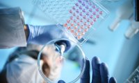 Fortschritte im Bereich HIV