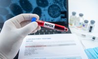 Mpox in der Schweiz 