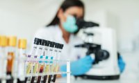 Fortschritte bei HIV-Therapie