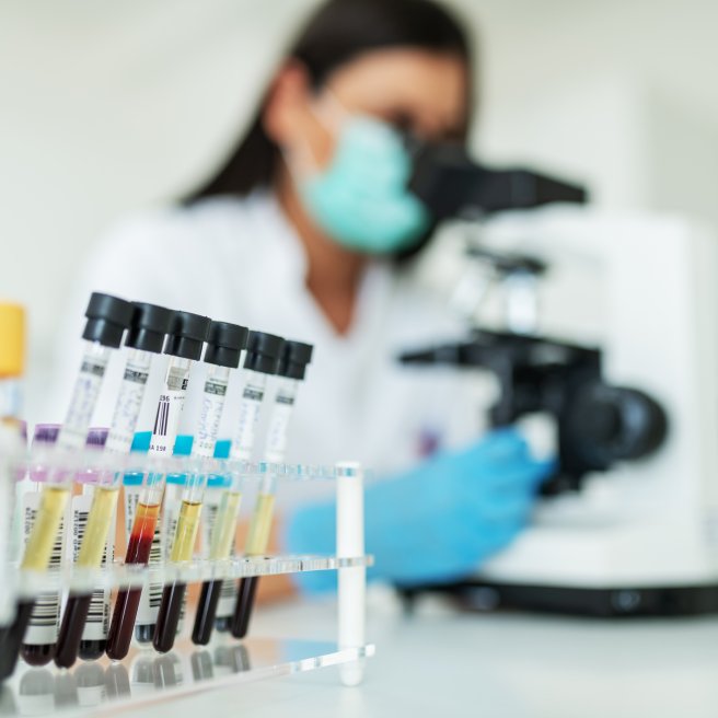 Fortschritte bei HIV-Therapie