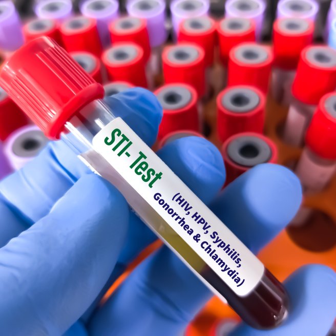 STI-Test (Symbolbild)