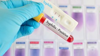 Syphilis-Erkrankungen in Deutschland verdoppelt // © jarun011