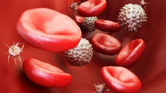 Neuer HI-Virus Stamm entdeckt