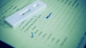 HIV-Ansteckungen gehen um 71 Prozent zurück