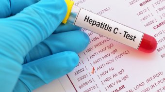 Hepatitis // © jarun011