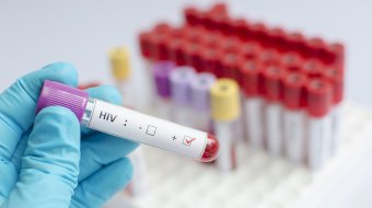 Weniger HIV-Fälle bei Schwulen