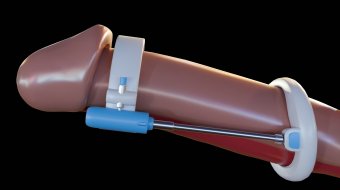 Ist Penisvergrößerung ein Tabu-Thema? // © Love Employee