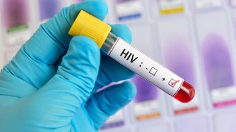 Anstieg von HIV-Neuinfektionen