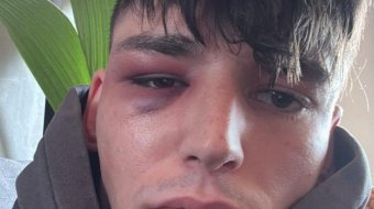 Anschlag auf Pascal Kaiser 