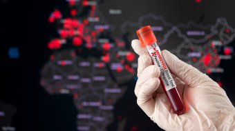 Neue Erkenntnisse zu Mpox 