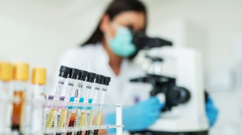 Fortschritte bei HIV-Therapie