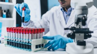 UNAIDS warnt vor Rückschritten 
