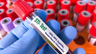 STI-Test (Symbolbild)