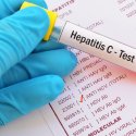 Hepatitis // © jarun011