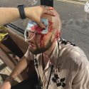 Schwuler Mann wird in der Bar angegriffen // © instagram.com/_ajben