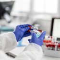 Geimpfte sollen bis Weihnachten Aids entwickeln