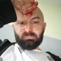 LGBTI*-Aktivist aus Montenegro beim Grabbesuch verprügelt