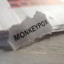Affenpocken als Angriffsmöglichkeit gegen Schwule 