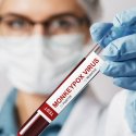 Affenpocken: 252 Todesfälle weltweit