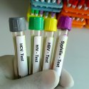 Antibiotikum gegen STI?
