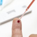 Revolution bei HIV-Tests!