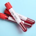 HIV- UND STI-TESTS UND BERATUNG