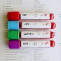 13 Checkpoints für HIV- und STI-Tests