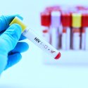HIV-Infektionen steigen an
