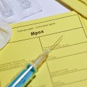 Mpox-Neuvariante vereint Viruslinien: Experten mahnen