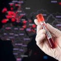 Neue Erkenntnisse zu Mpox 