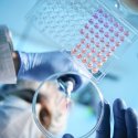 Fortschritte im Bereich HIV