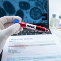 Mpox in der Schweiz 