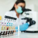 Fortschritte bei HIV-Therapie