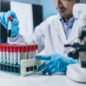 UNAIDS warnt vor Rückschritten 