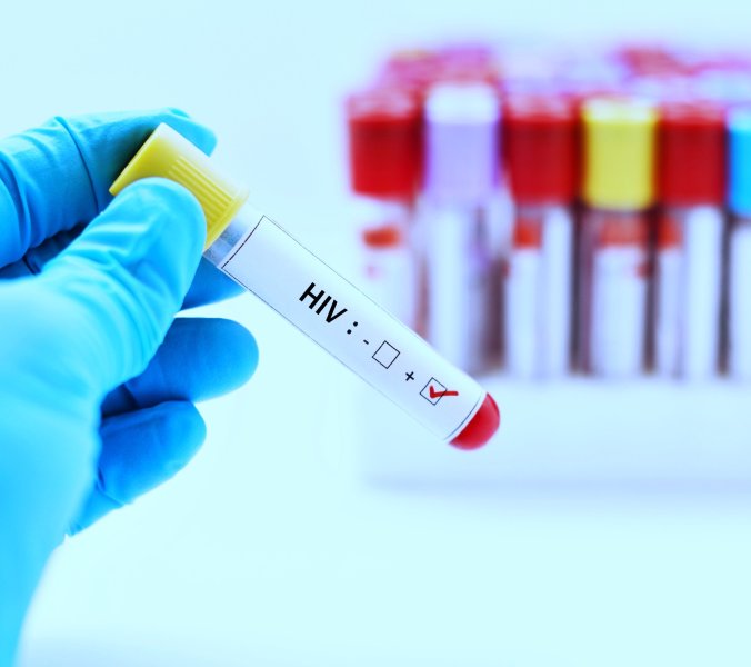 HIV-Infektionen steigen an