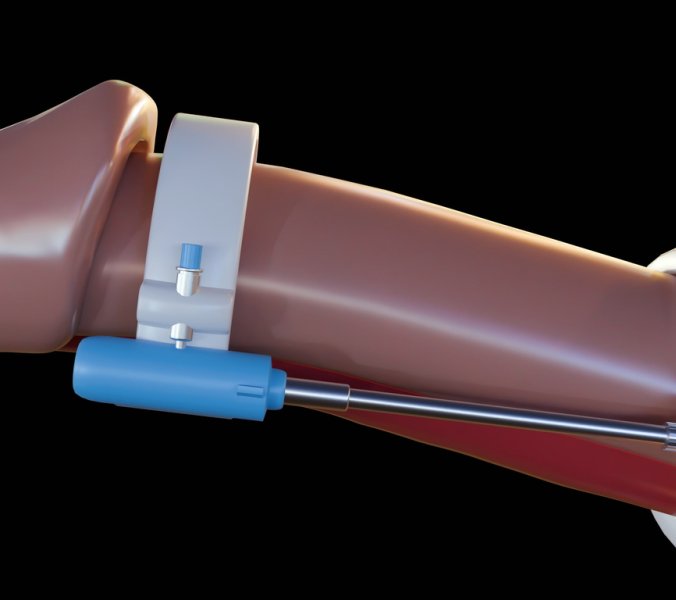 Ist Penisvergrößerung ein Tabu-Thema? // © Love Employee